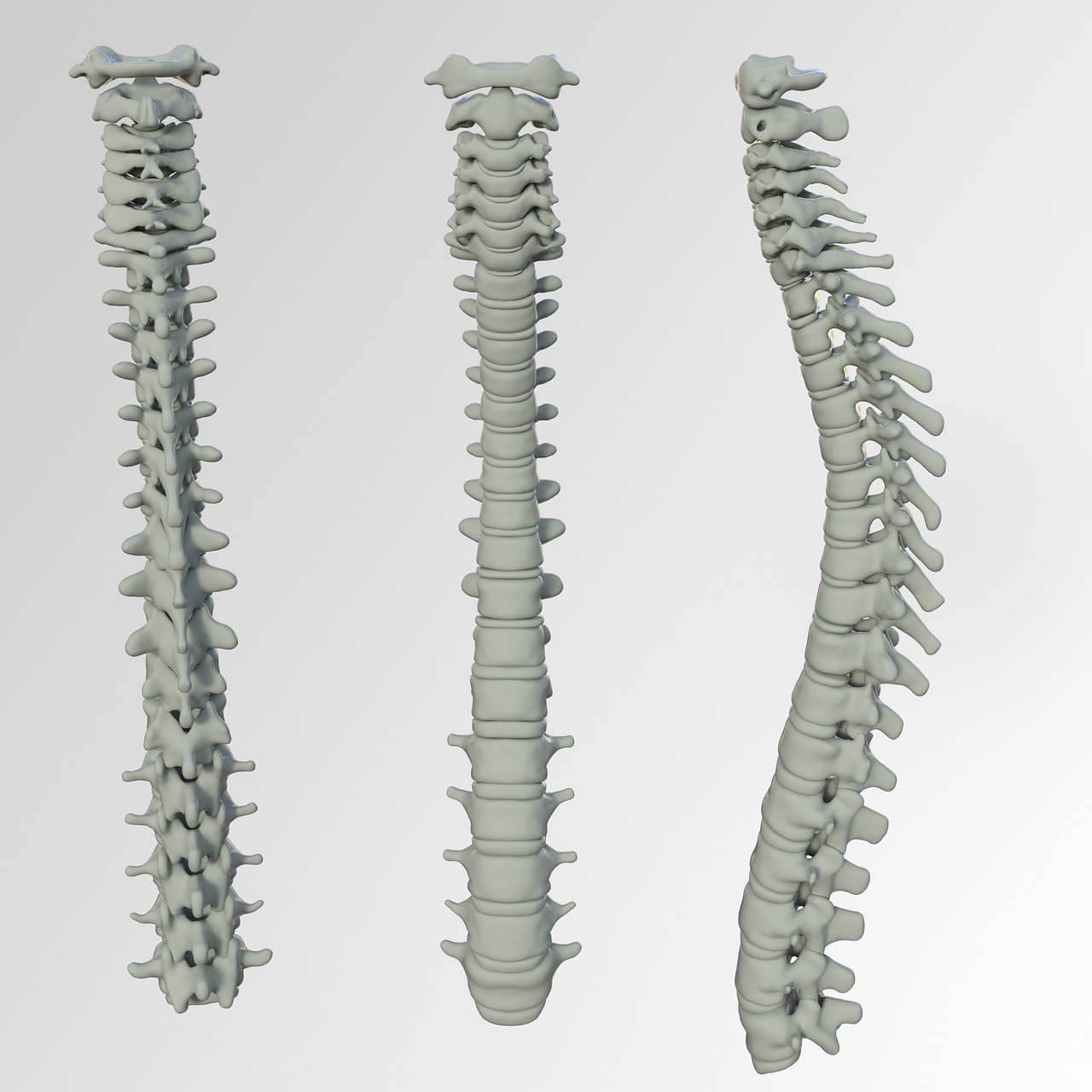 Spinal Screenings Waukesha, WI